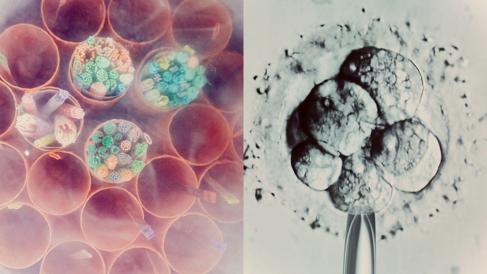 The Embryo Limbo Problem